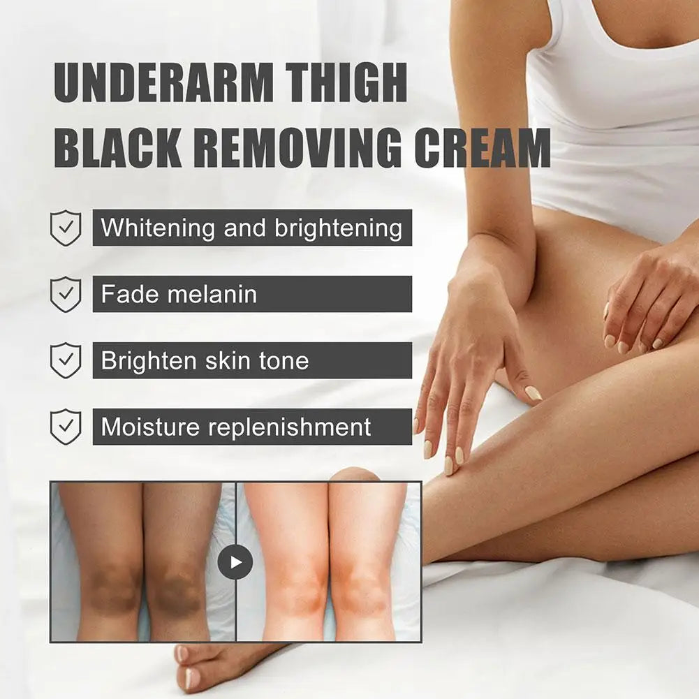 Whitening Underarm Cream for Armpit, Neck, Knees, Elbows, Inner Thigh, Dark Spot Corrector Cream Brightening Natural Skincare