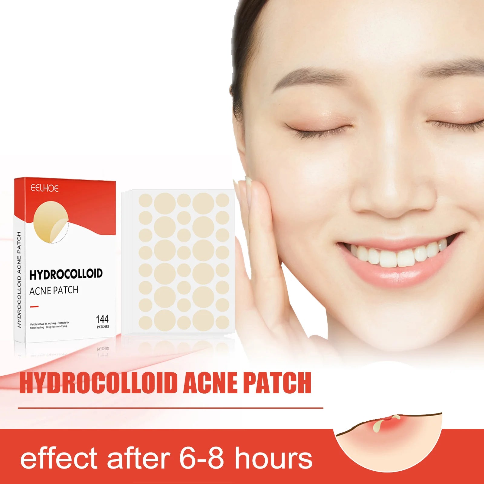Hydrocolloid Acne Patches